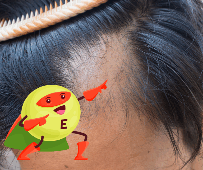 Vitamin E bei Haarausfall – natürliche Unterstützung bei Alopezie